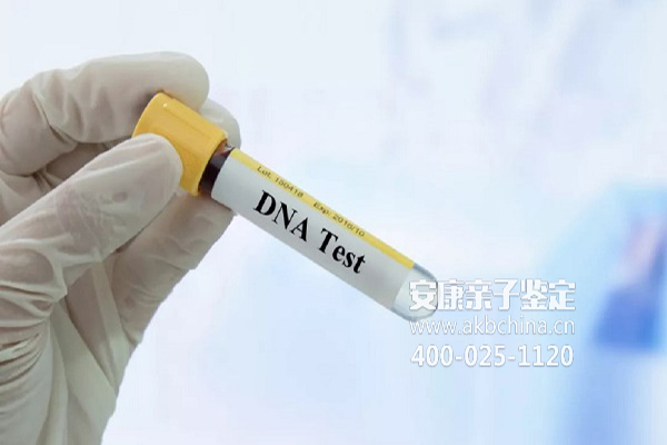 云南DNA为什么需要做亲子鉴定 